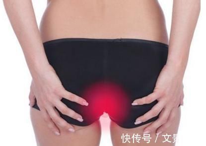 痔疮|痔疮还是肠癌，记住4个“区别”，能让你远离“肠癌”，一起学习