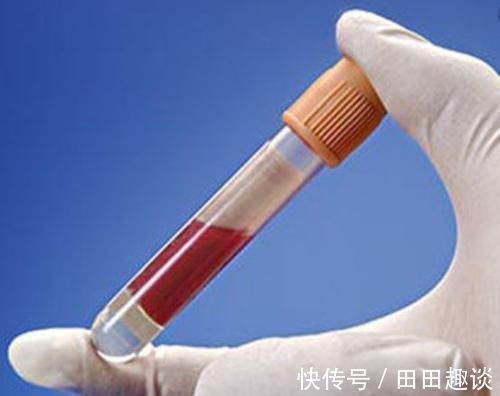 医生|不管高血脂多久,医生春天坚持3件事,养血管调血脂,人更精神