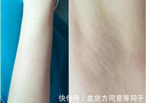 拆君|评测 ｜ 历时30天，真人实测娜蜜丝冰钻6.5高能量光子脱毛仪