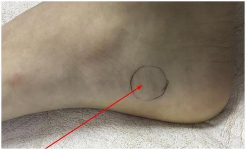 排尿|前列腺最怕2个穴位,每天按压10分钟,不出5周,尿频尿急好转