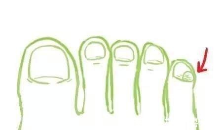 大槐树#纯正血统汉族人有一个共同点小脚趾甲是两瓣原因令人颇感意外!