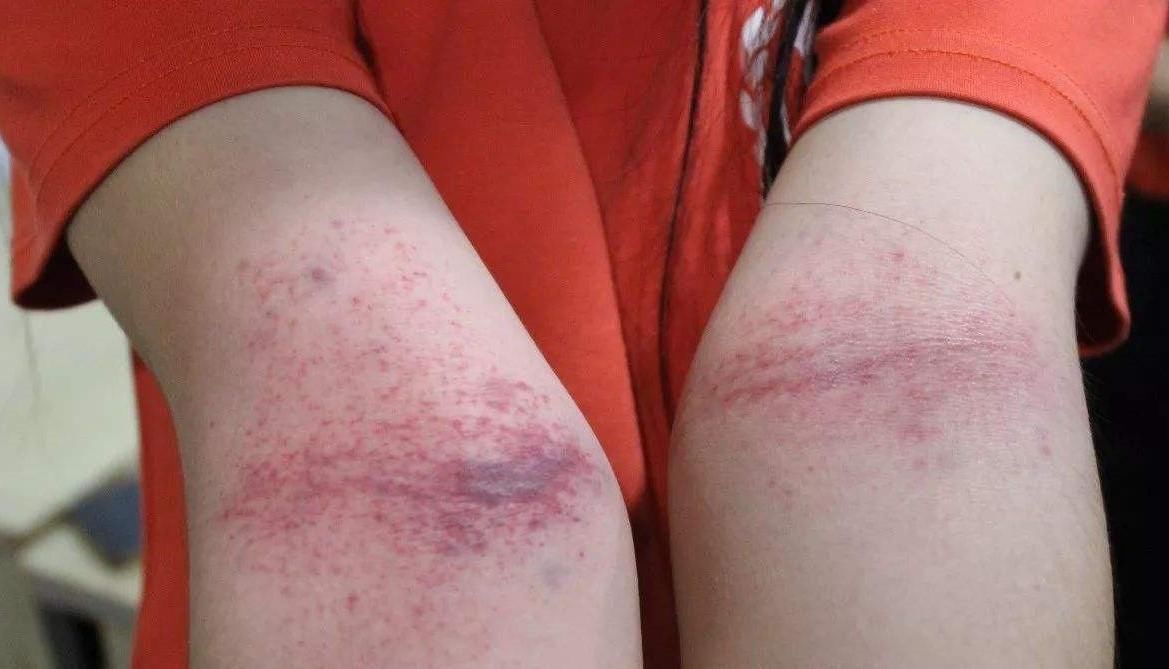 凹陷处|身体出现“痛、麻、冷、酸”，或是经络“堵”了，3个动作能疏通