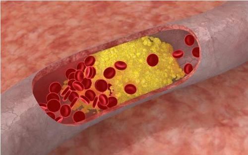 关节|男人步入衰老时,身体3处变硬,2处变大,占两个,就该注意保养了