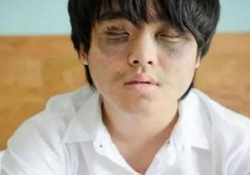 肝不好？送你3个好习惯，或许对你养肝护肝有帮助