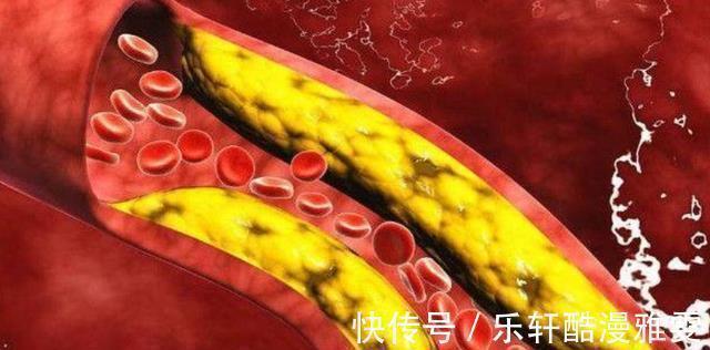 三高|人过50岁，想要健康长寿，4个“养生”误区，建议尽早避开