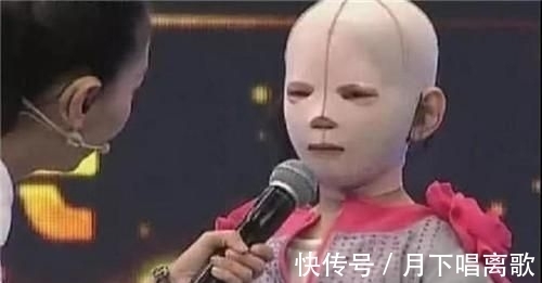 一场车祸,让这位6岁的小女孩戴着头套上学,受尽同学无尽的嘲笑