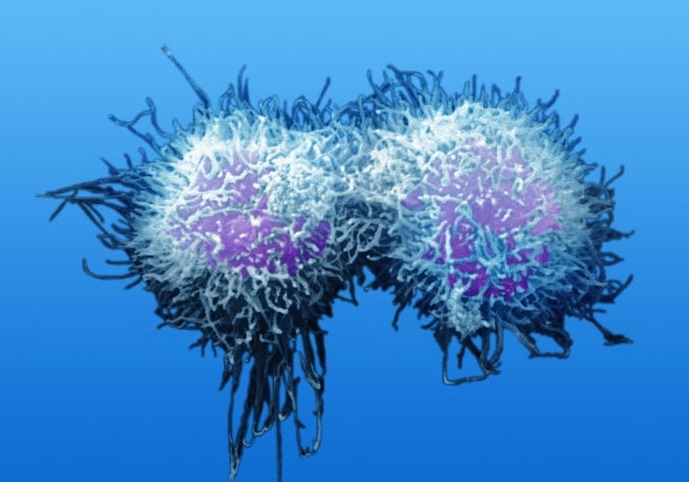 肝脏|三个症状不断出现,十有八九是进展期癌症,不可一拖再拖