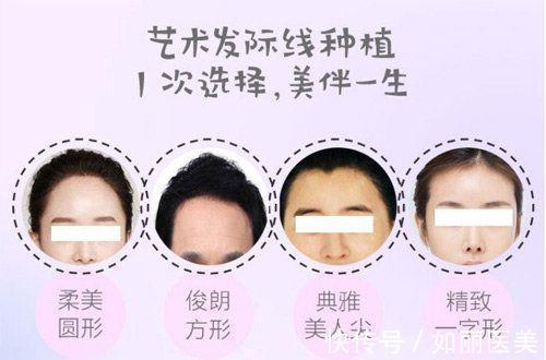 技术 植发技术好不好?植发和微针植发哪个好?优缺点分析