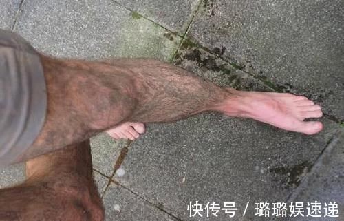 旺盛|为何有人腿毛旺盛,有人却“光溜溜”?女护士说出3因素,贼真实
