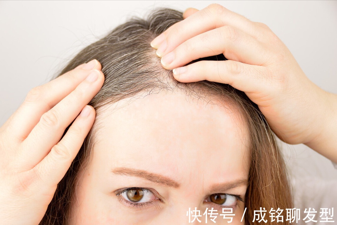 头发 40岁头顶的头发都白了,不想染发,有啥好办法让白发变黑发吗?