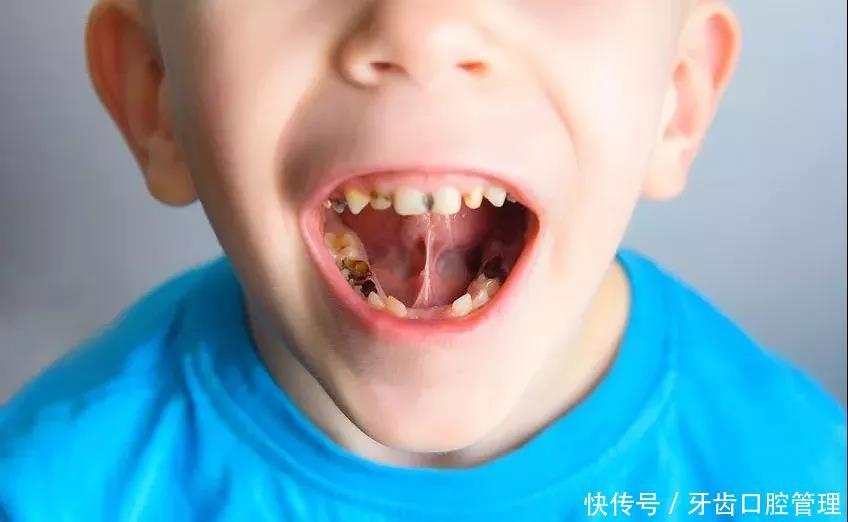 牙齿|每个去看牙的孩子,牙齿都疼好久了