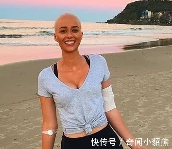 医生|女孩患癌医生却称她是臆想出来的,一年多才被查出但已扩散到全身