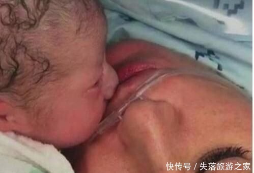 剖腹产|宝宝出生时,有的睁开眼,有的闭上眼,哪种比较好医生说都好