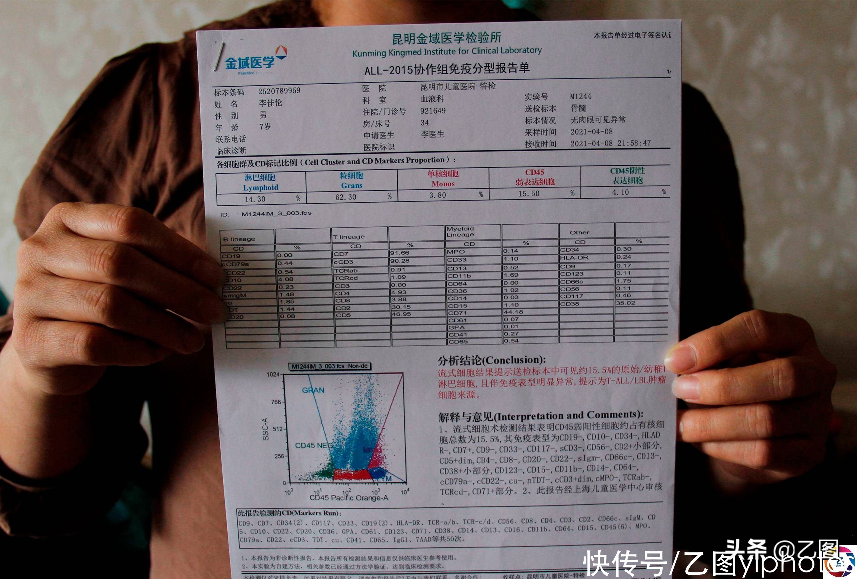 化疗|男童脸上出现红点，家人以为被蚊虫咬了几口，检查结果让妈妈崩溃