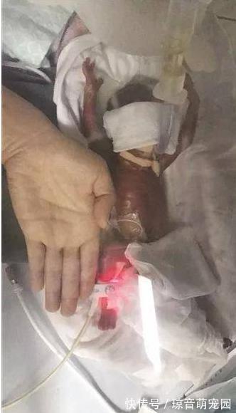 体重|在娘胎里只呆了22周的宝宝,出生时体重仅为245克,世界最小婴儿