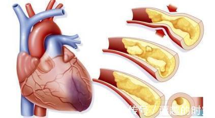 医生|10岁男孩晕倒抢救无效死亡,医生都怪父母疏忽了一件事