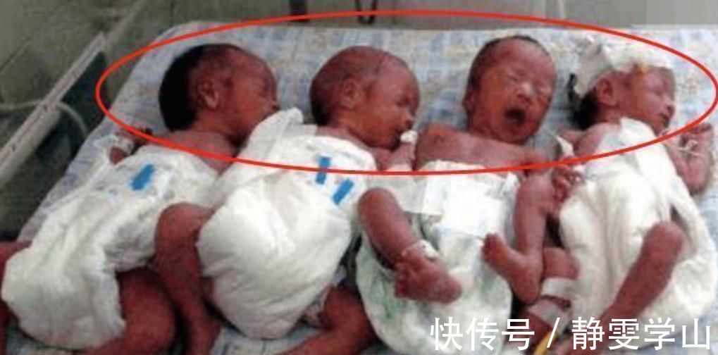 安娜|俩闺蜜生了两对双胞胎,4个娃是同一个爸爸,原因让人感动