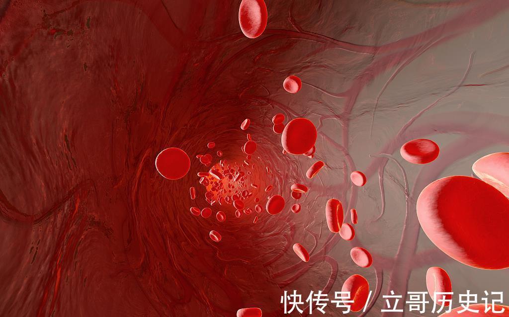 高血脂患者|高血脂患者不能喝豆浆?心内科教授:想要血脂稳定,3物可多吃