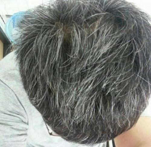 为什么总有人少年白发?黑芝麻真的能让头发变黑吗?一起了解一下