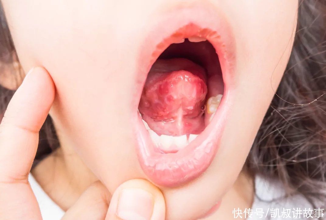 感染|这些“哄娃神器”也能感染“手足口病”，看看你家孩子在用吗？