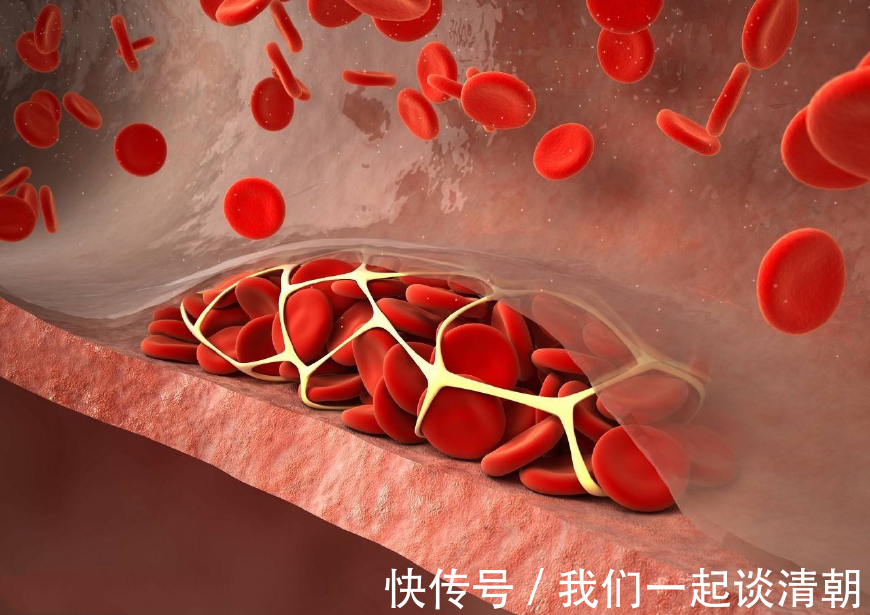 强心脏|此物是三高的“死对头”,化血栓,强心脏,很多人当垃圾扔了