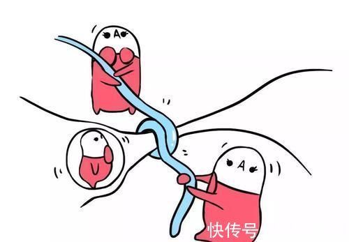 女人|女人避孕的方式有很多种,除了上环,还有哪些科学的避孕方法呢?