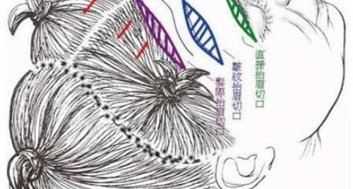 做拉皮要多少钱？先来了解一下