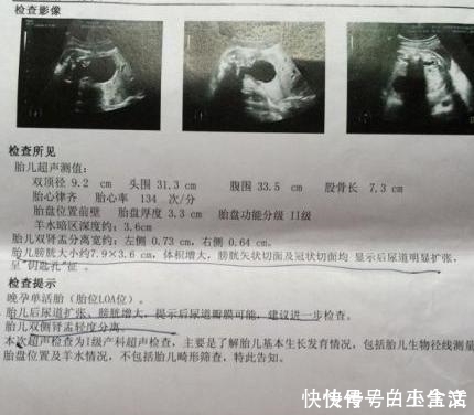 妈妈们|B超单上若有这五个字,孕妈就乐吧,可能是“小淘气”来敲门了