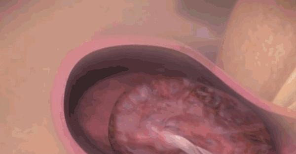 营养物质|宝宝出生后,产妇身体会发生什么变化看完忍不住心疼!