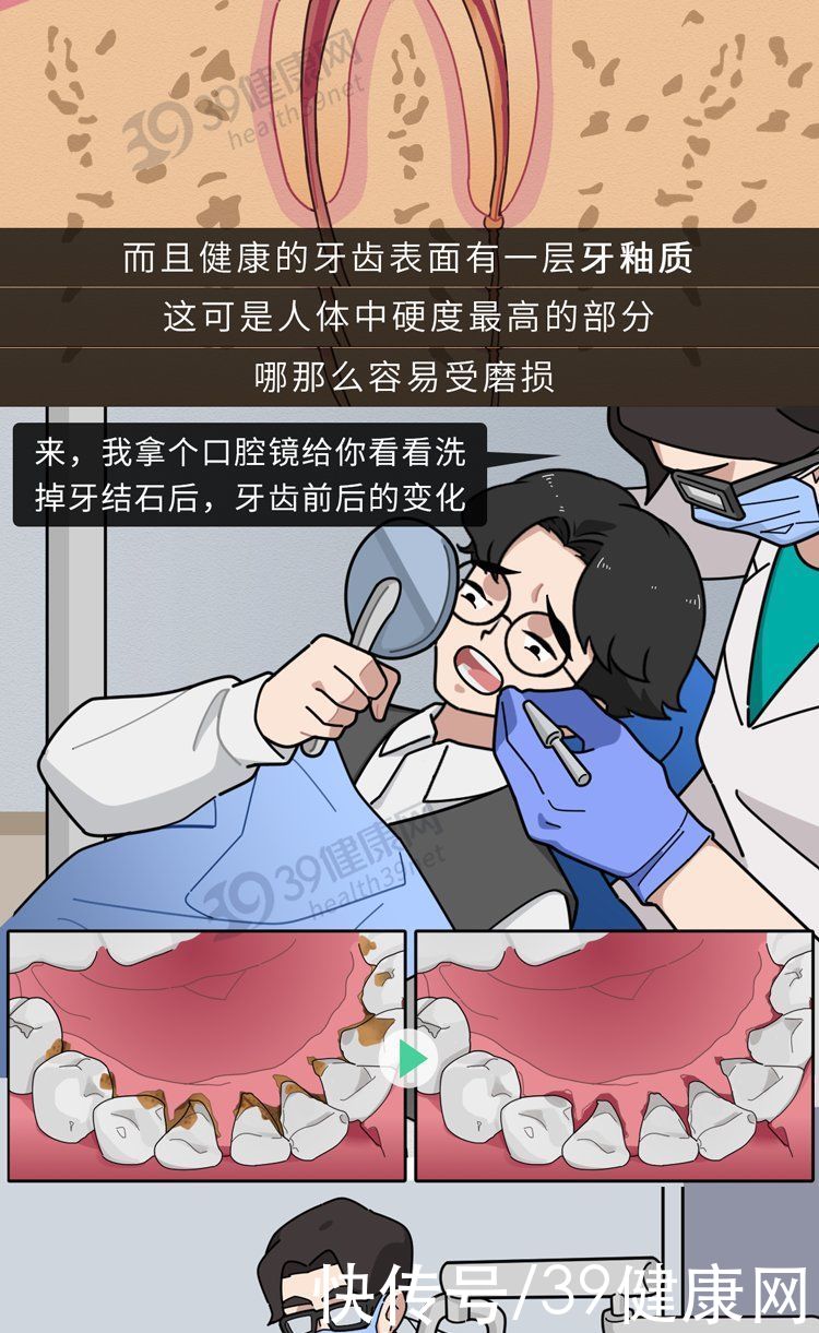 中华|不洗牙，你永远不知道牙齿里面有多脏！看完这篇就拿定主意了