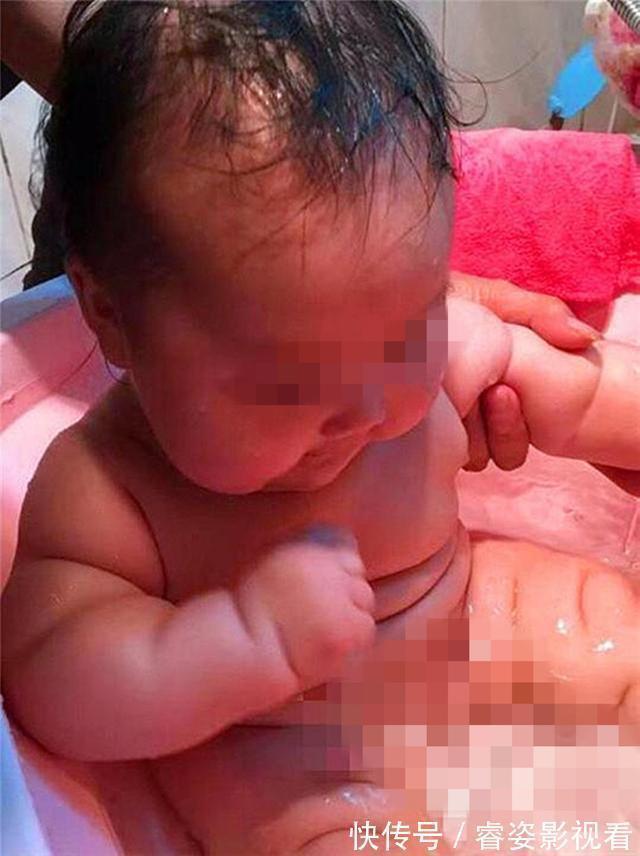 孙子|奶奶养出“米其林”宝宝,炫耀孩子吃得好,好心人:快去医院检查