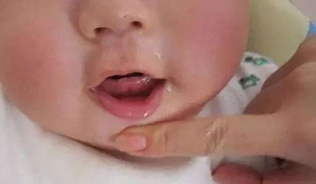乳牙|宝宝出牙时间暗示健康状况,出牙晚不一定缺钙,父母越早知道越好