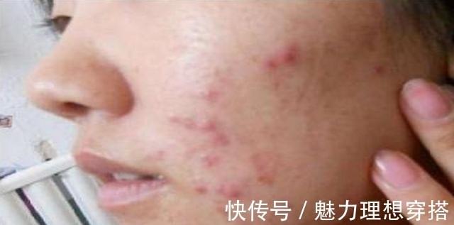 脸部|女性脸部有4个“症状”别马虎,可能得了妇科病,要足够重视