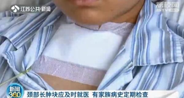 肿瘤|12岁女孩长“喉结”一查竟是甲状腺癌