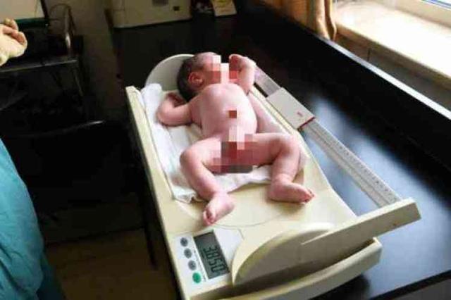 北京医科大学|我国首例“试管婴儿”32岁了，他过得怎样？结果让很多人失望了