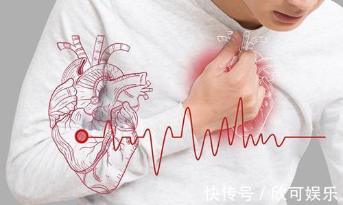 高血脂|多走路可以降血脂吗医生尝试多吃4种食物,或比走路效果还好