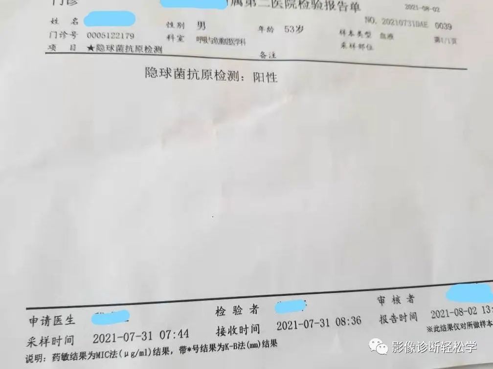 肉芽肿|快快乐乐过大年 无难度学习肺隐球菌感染！