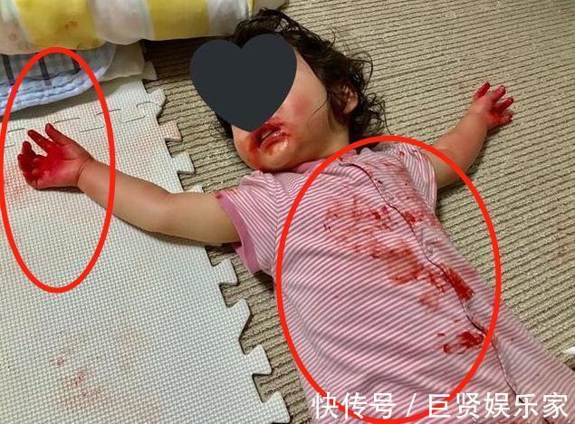 项链|5岁女儿暴瘦,医生检查后让娃“摘下项链”,妈妈懵了她没戴啊
