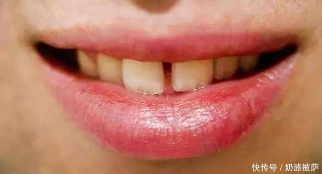  颜色发|提醒：如果你的舌头是3种颜色，要当心，很可能是健康出了问题