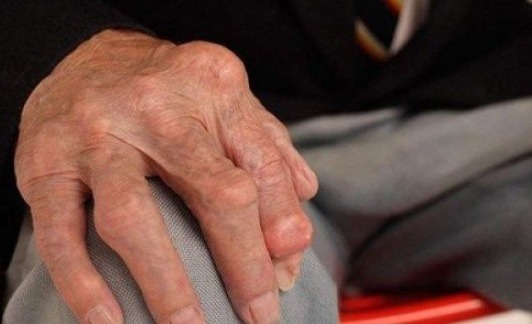 关节|被关节疼反复折磨1把韭菜“药到病除”，试过的都说好！