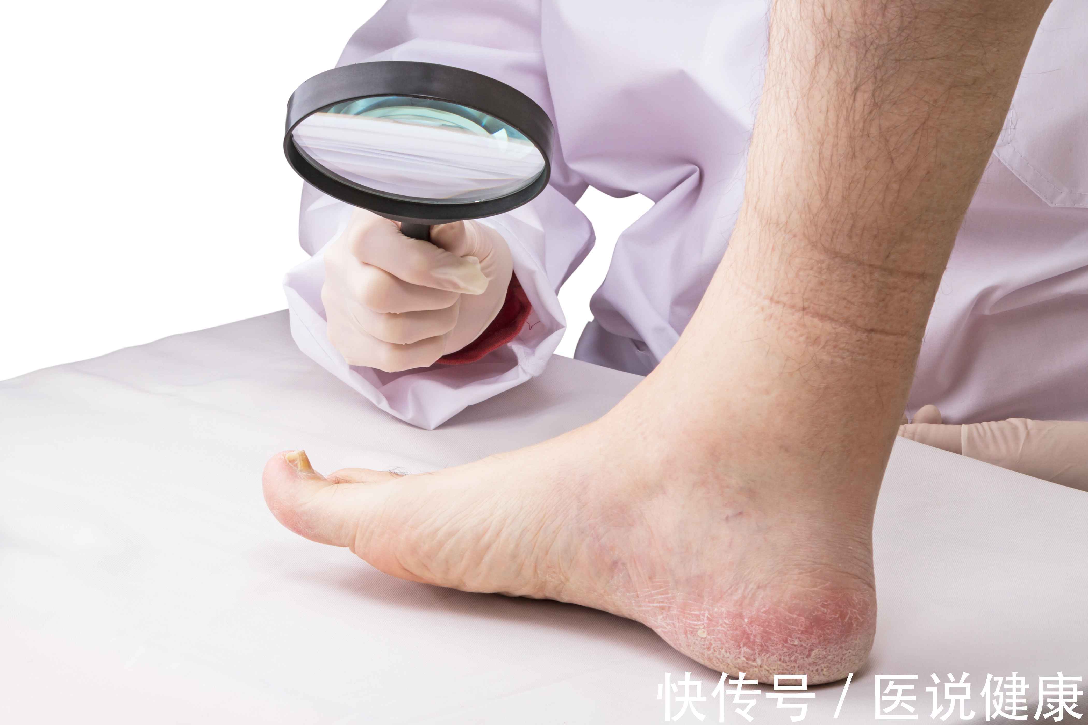 身体|血管堵塞,危害不容小觑,身体这6处会受到影响,需重视起来