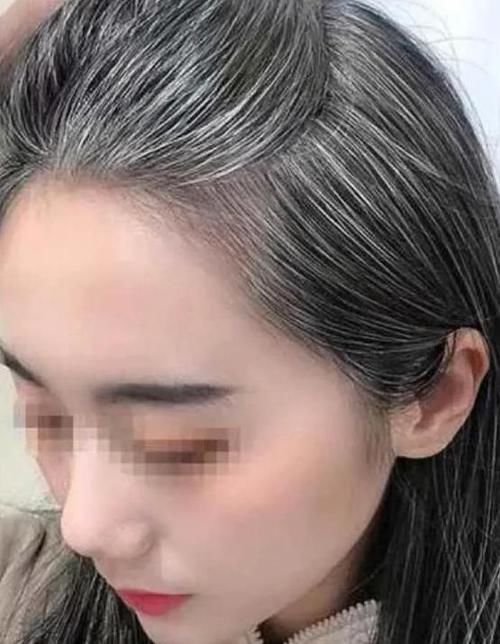 营养|如果女性白头发增多,不要总认为老了,或是因为体内缺乏3种营养