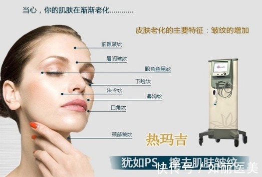 step 热玛吉价格一般是多少?千万别掉坑!