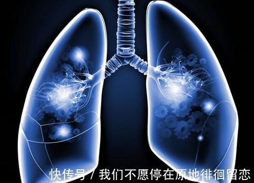 肺部|肺部“清洁工”被找到，不是猪血而是它，泡水喝，肺或焕然一新