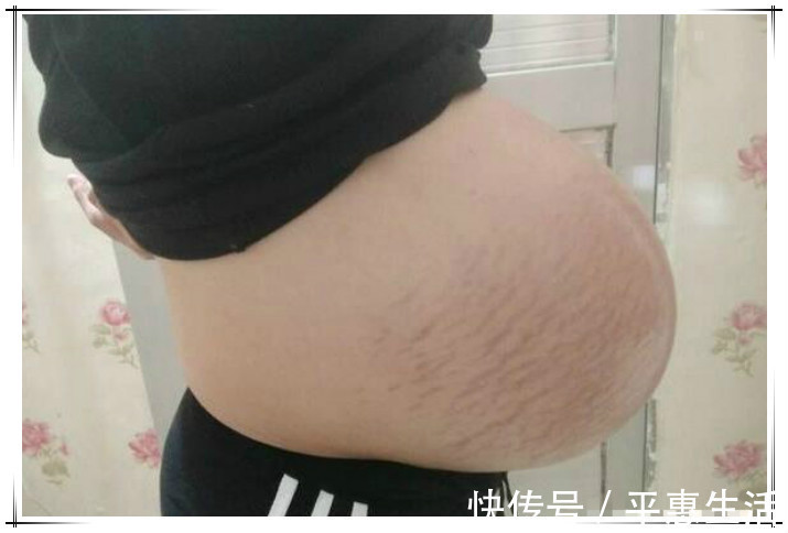 肚子|孕妇“悬垂肚”走红,网友猜测是“双胞胎”:没见过这样的孕肚
