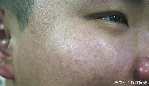 “中年油腻大叔”的标准已出，40岁后的男性，很多人中招，望你无