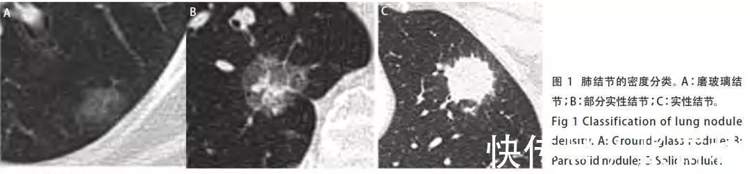 华纳药业|华纳药业:正确了解肺结节,不要乱治疗,也不要被吓死
