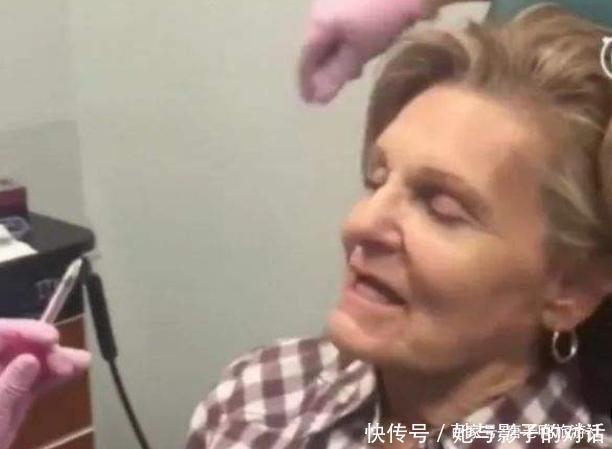 神奇|玻尿酸到底多神奇80岁外国老奶奶亲自实验,一小时后惊艳全场!