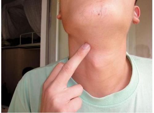 营养|3个表现是孩子发育的“绊脚石”，儿科院士：长高难，家长别坑了孩子