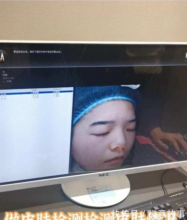 仪器 医美界的万金油,光子嫩肤探店!